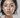 Is my skin catching a cold?