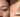 Korean Skincare for Summer Closed Comedones: Clear Bumpy Texture