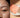 Korean Skincare for Summer Closed Comedones: Clear Bumpy Texture