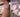 Korean Skincare for Summer Melasma: Brighten Sun Spots Now