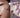 Korean Skincare for Summer Melasma: Brighten Sun Spots Now